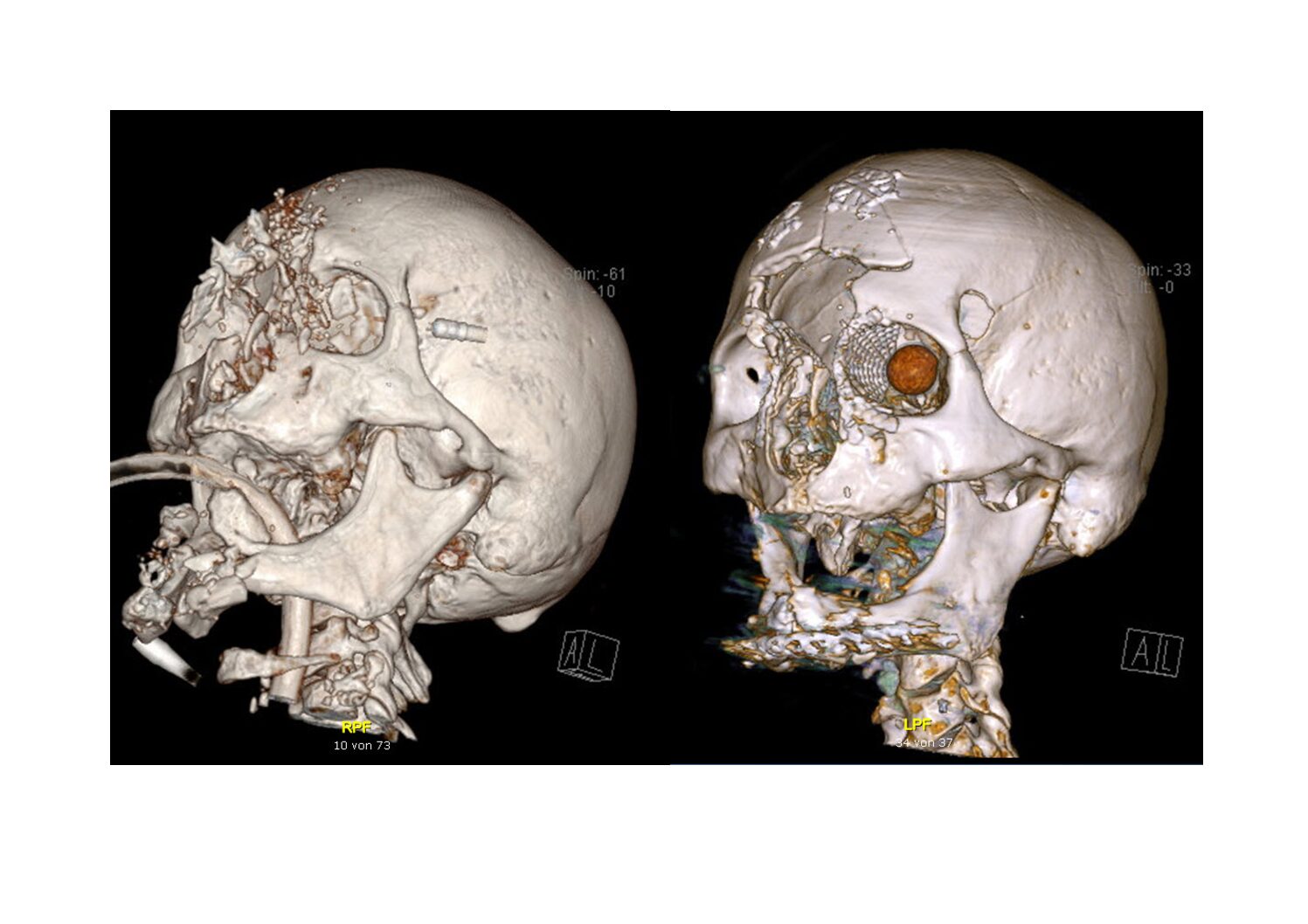Figure_final Hochschule Zürich